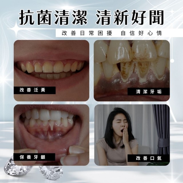 口氣救星!!💎星鑽377清新護齦淨白牙膏 100g 【一組2條(同款)】